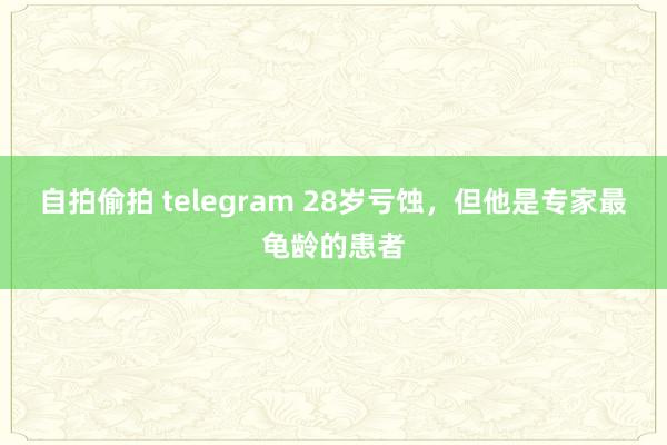 自拍偷拍 telegram 28岁亏蚀，但他是专家最龟龄的患者